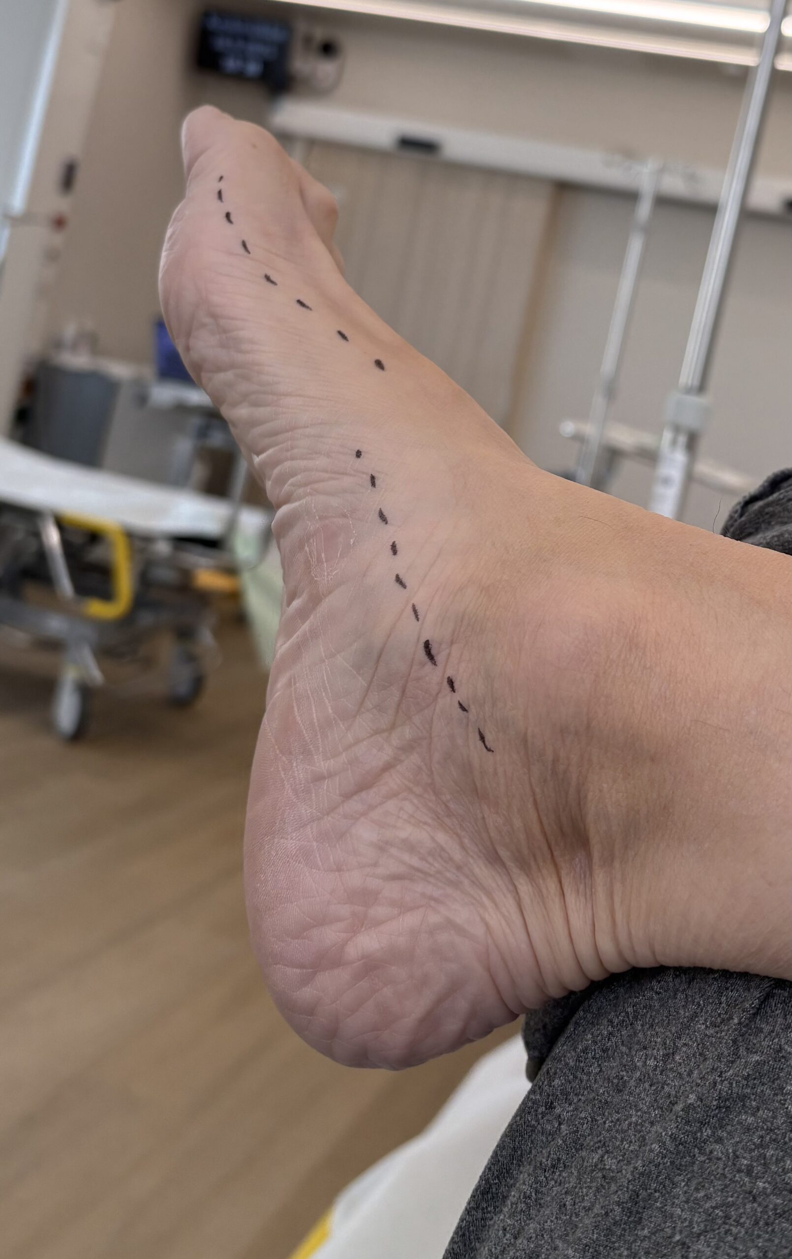 Leikkaukseen valmistautuminen