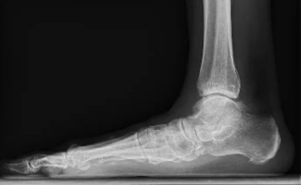 Leikkauspäätöksen synty